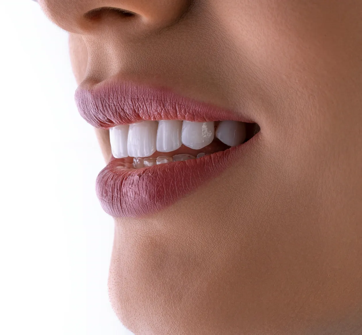 Sorriso com dentes brancos e alinhados (foto de amostra)